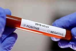 Covid-19: Alagoas registra 309 novos casos e tem 115 pessoas internadas
