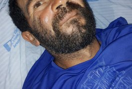 HE do Agreste procura familiares de paciente de Girau do Ponciano que está internado