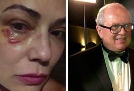 Defesa diz que ex-marido tem prova de 'descontrole' de Luiza Brunet