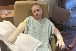 Menino de 12 anos fica internado após se queimar fazendo trend das redes sociais