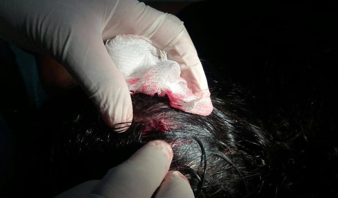 Universitária é assaltada e agredida fisicamente por criminoso em Maceió