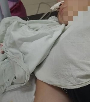 Família denuncia que profissionais de hospital esqueceram gazes na barriga de paciente após parto, em Arapiraca