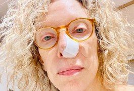 Marília Gabriela descobre câncer “sorrateiro” e passa por cirurgia