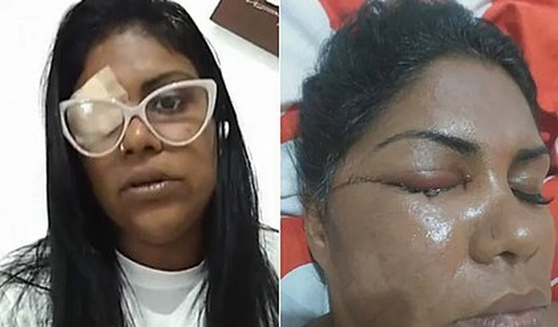 Mulher perde visão de um olho após agressor se irritar com samba em homenagem a Exu