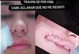 Justiça mantém prisão de suspeito que mordeu turista em tentativa de assalto em Maceió