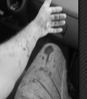 Funcionário de van fica ferido após ser agredido com coronhada durante assalto, em Arapiraca