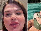 Thais Carla se prepara para cirurgia de remoção de pele após perder 120 kg