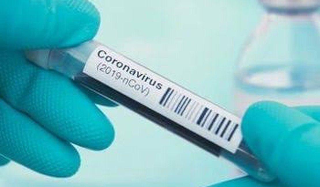 Boletim covid-19: Alagoas soma 20.887 casos confirmados e 723 mortes