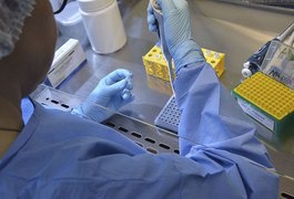 Universidade brasileira inicia teste de vacina contra Covid-19