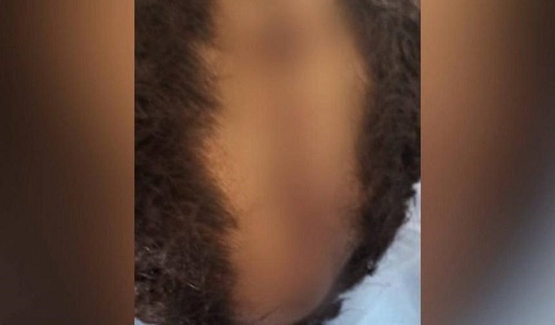 Pai não aceita corte de cabelo do filho de 10 anos e arranca couro cabeludo com faca: “De homossexual”