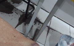 Idosa foi agredida por sobrinha que é médica, em Arapiraca