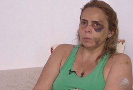 Ex-namorada denuncia humorista por agressão