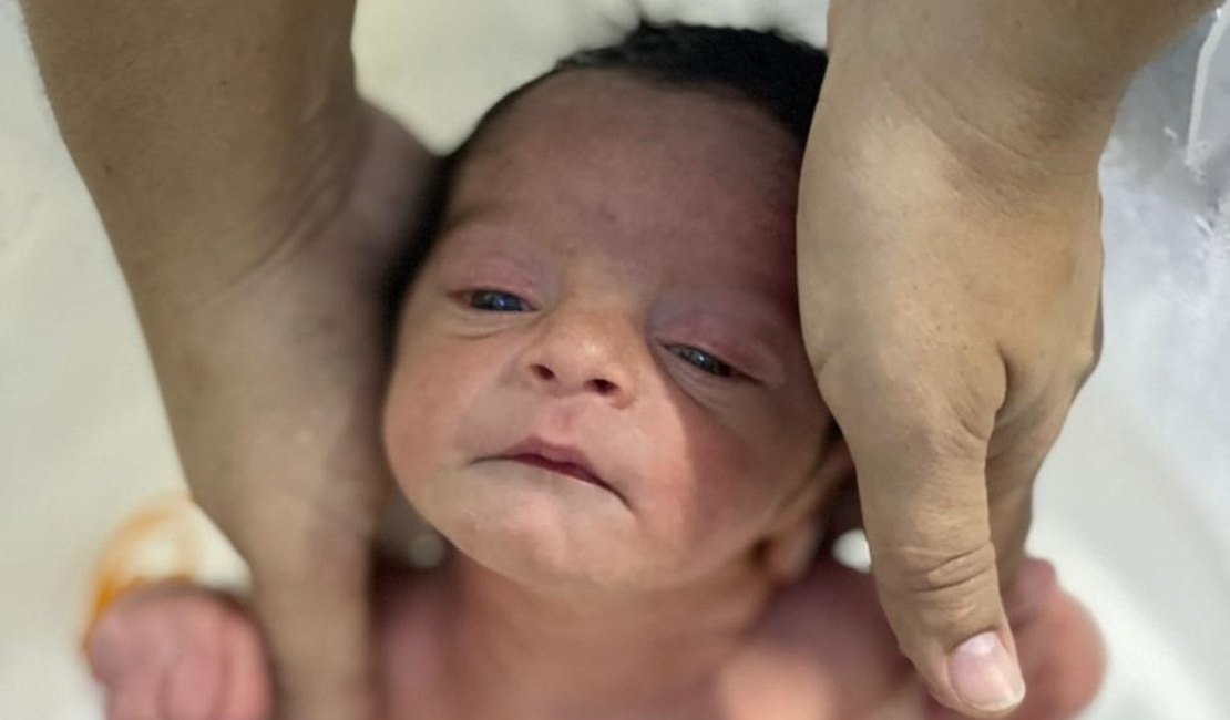 Semana da Amamentação: Hospital Regional de Arapiraca oferece banhos de ofurô para bebês