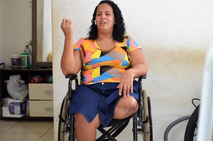 Maio Amarelo: Trabalhadora que perdeu a perna em acidente na Rota do Mar é salva pelo HGE