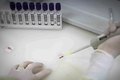 Paciente em SP com suspeita de ebola testa positivo para meningite
