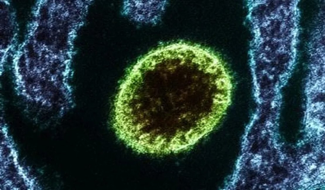 Surto de vírus letal Nipah deixa Índia em alerta; conheça os riscos do microrganismo