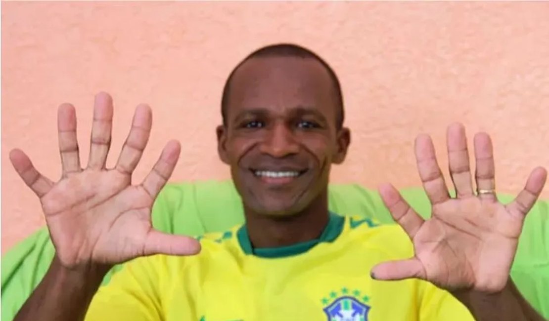 Baiano com seis dedos pretende comemorar hexa da seleção com uma mão só