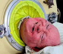 Homem que viveu em 'pulmão de ferro' há sete décadas morre aos 78 anos