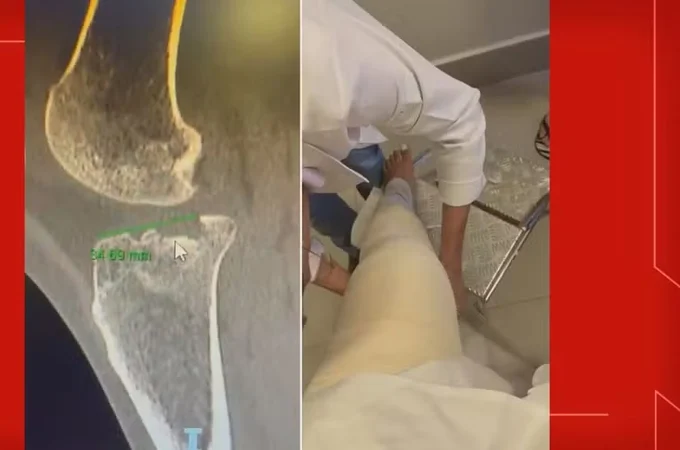 Homem invade vagão exclusivo para mulheres no metrô do DF, assedia e agride passageiras