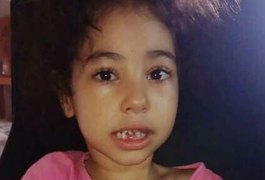 Menina arapiraquense com síndrome rara, microcefalia e APLV precisa de ajuda; latas de leite especial custam R$ 240