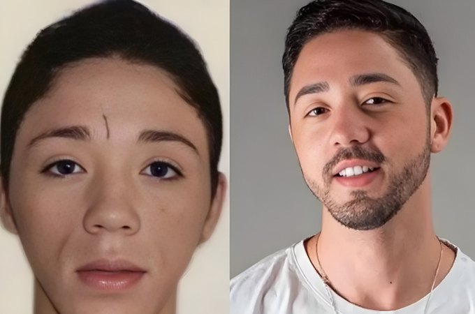 Rico Melquíades é barrado em Dubai após fazer harmonização facial