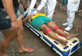 Professora é atropelada em São Miguel dos Campos