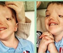 Instagram retira foto de menino com deficiência considerada 'ofensiva'